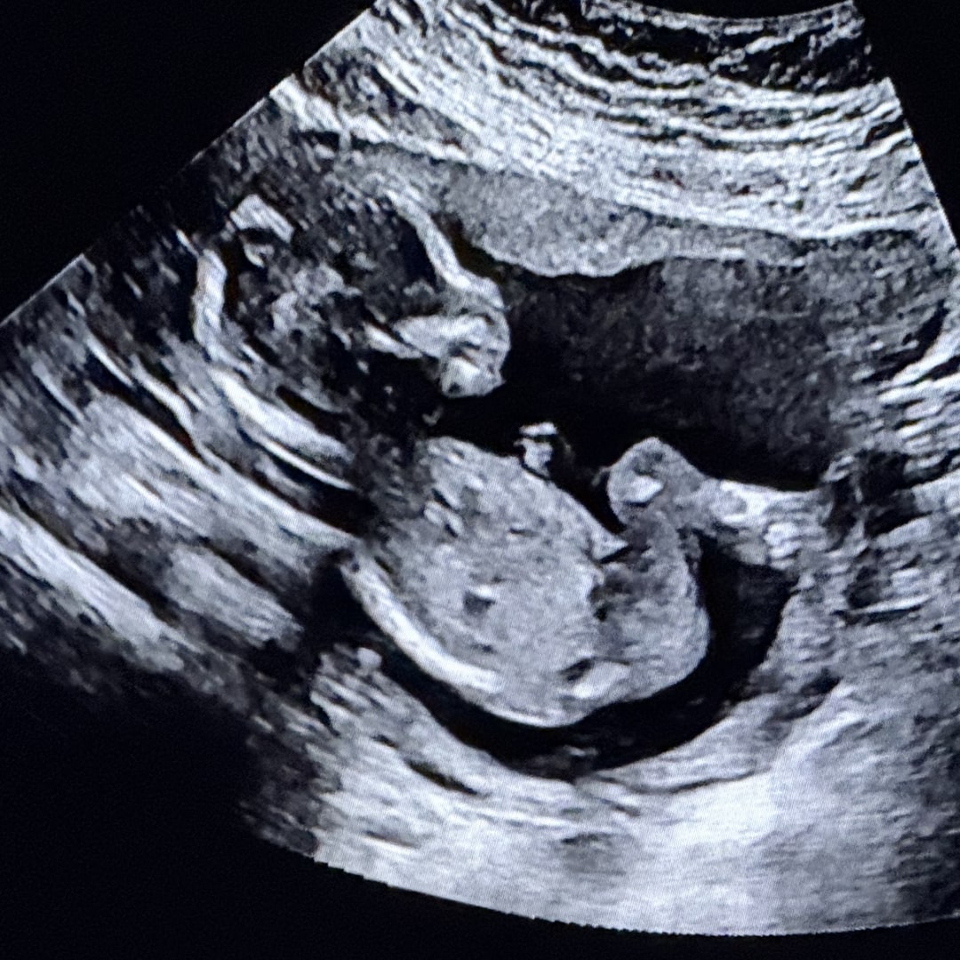 Photo shared by Cristina for their Babylist baby registry.