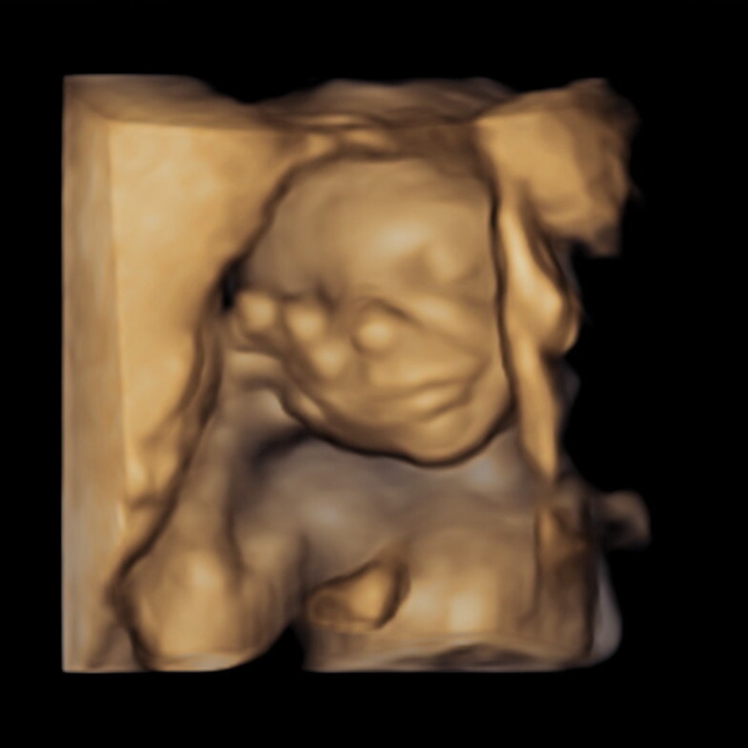 Photo shared by Ansley for their Babylist baby registry.