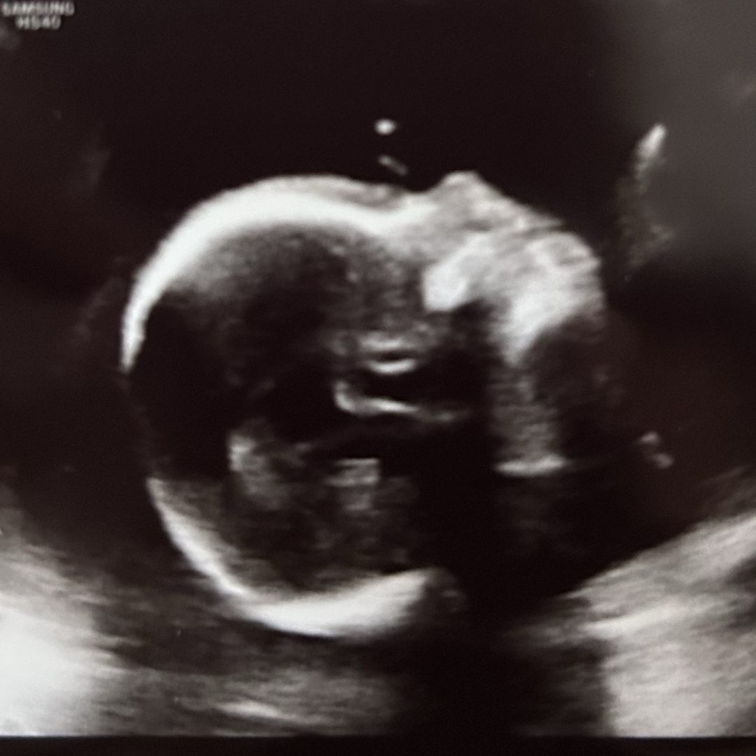 Photo shared by Kelsey for their Babylist baby registry.