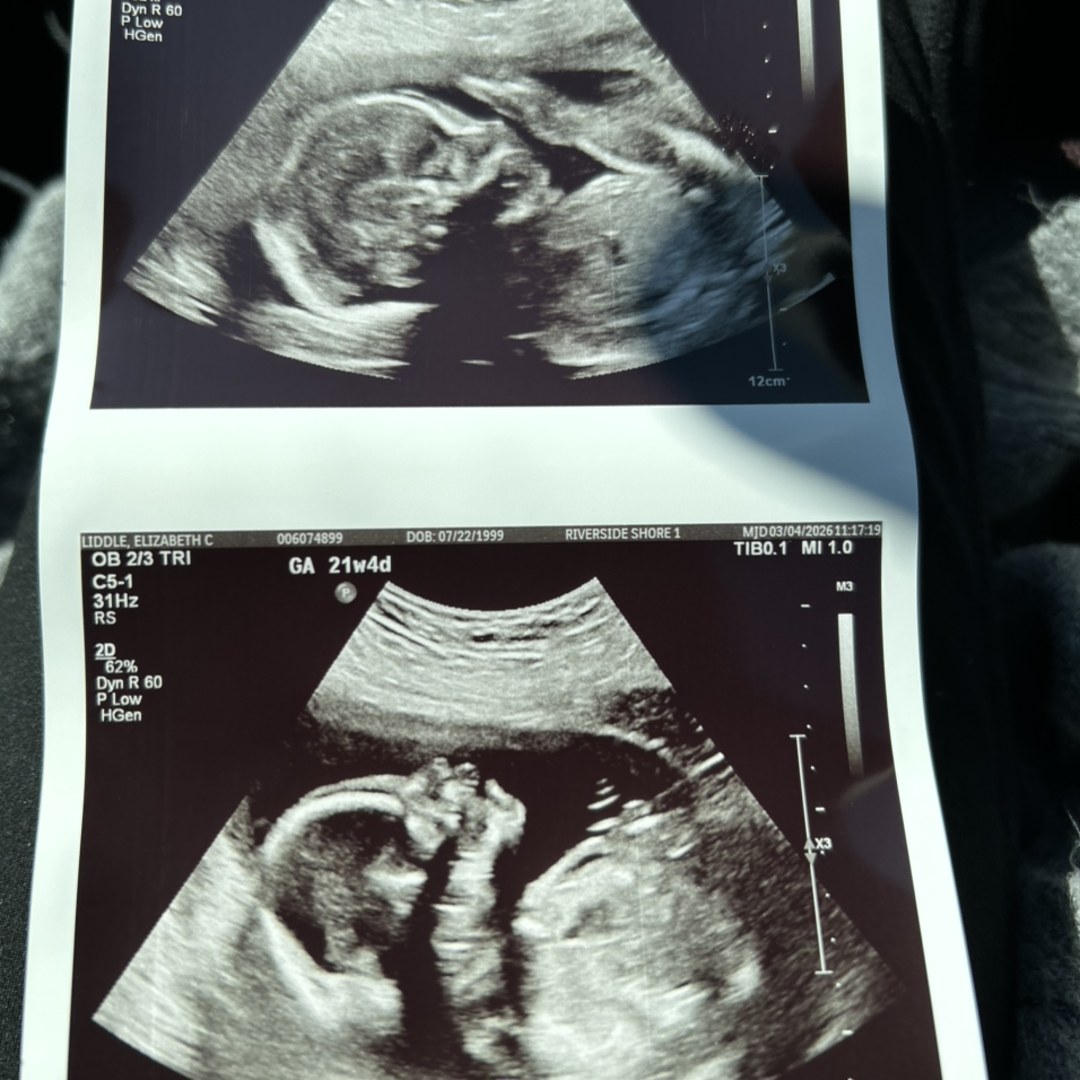 Photo shared by Liz for their Babylist baby registry.