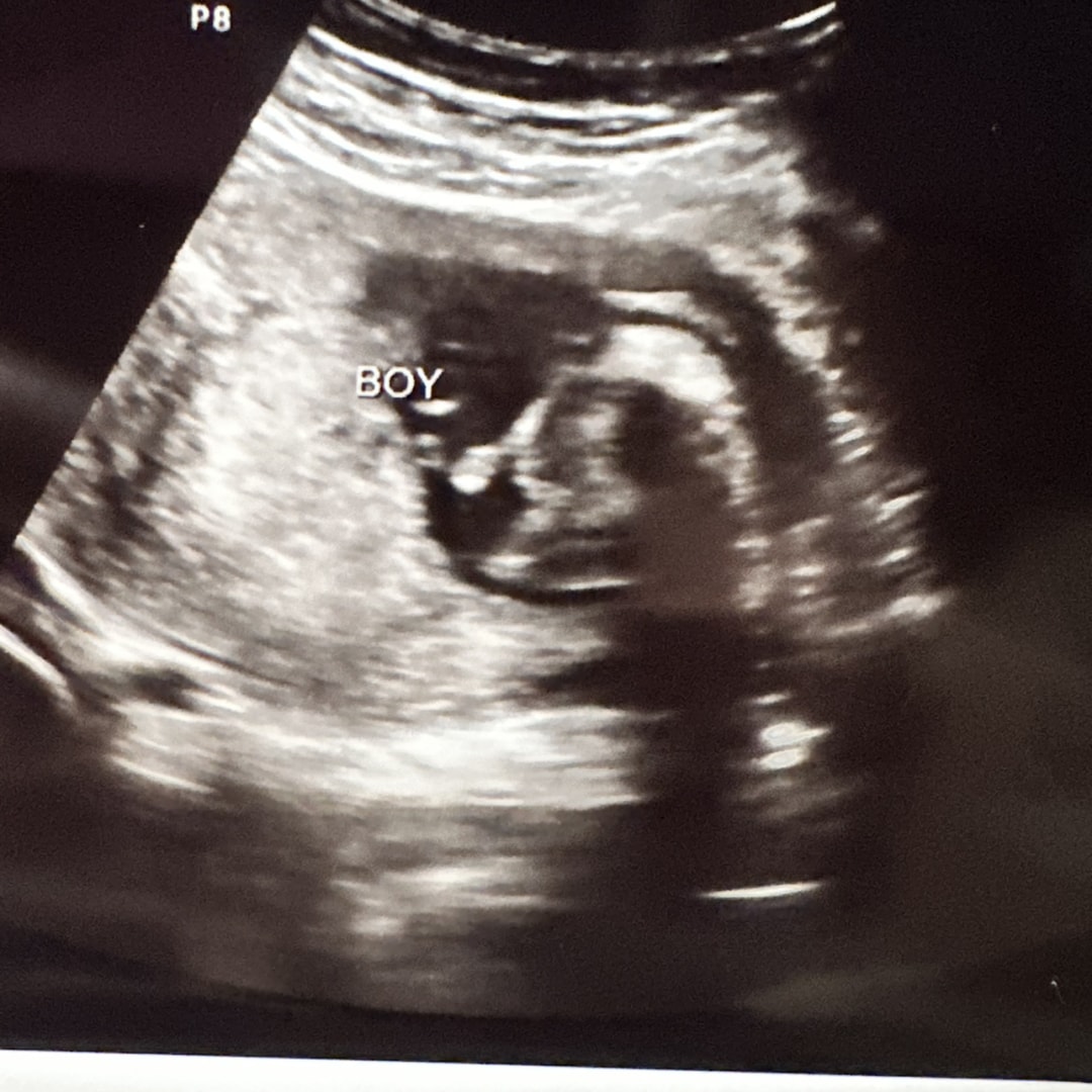 Photo shared by Daisy for their Babylist baby registry.