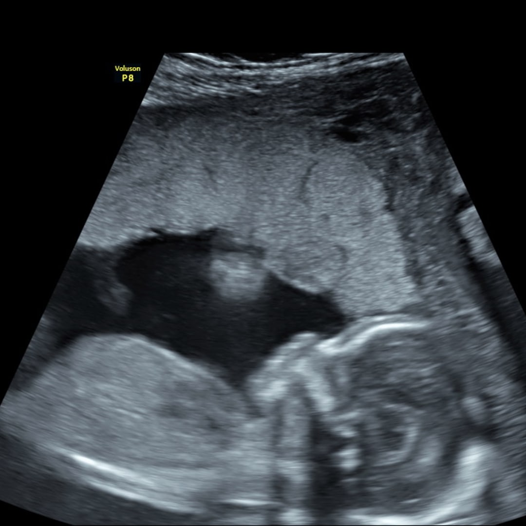 Photo shared by Mindy for their Babylist baby registry.