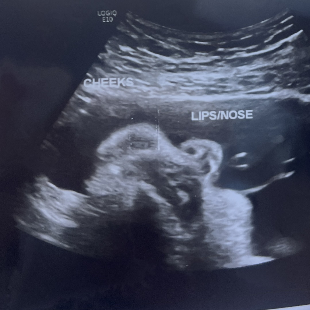 Photo shared by Xena for their Babylist baby registry.