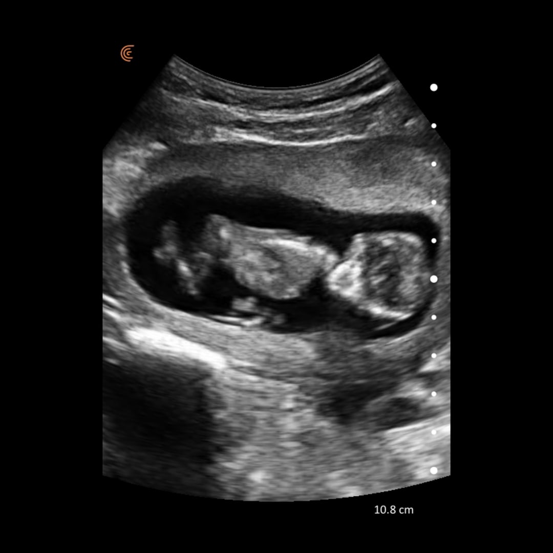 Photo shared by Audrey for their Babylist baby registry.