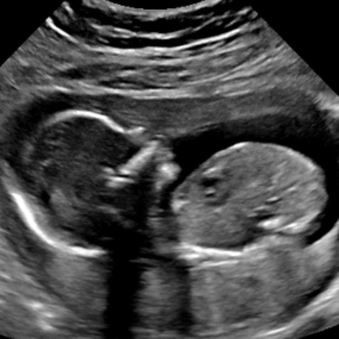 Photo shared by DeLenn for their Babylist baby registry.
