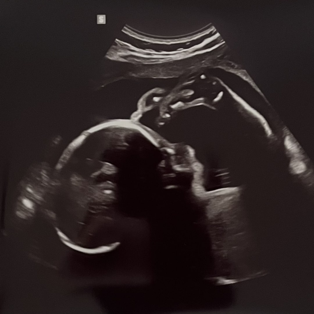 Photo shared by Allison for their Babylist baby registry.