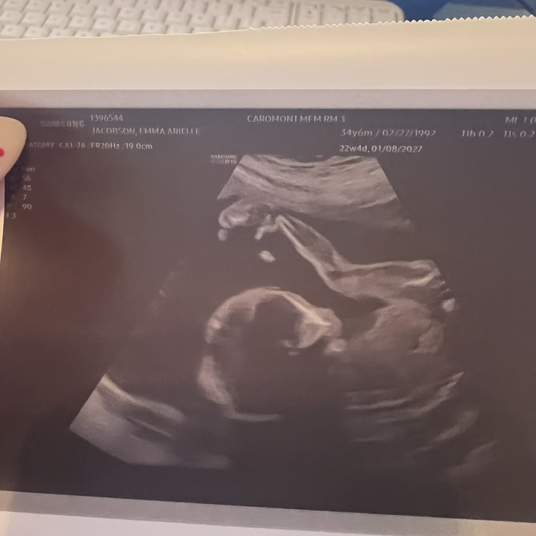 Photo shared by Emma for their Babylist baby registry.
