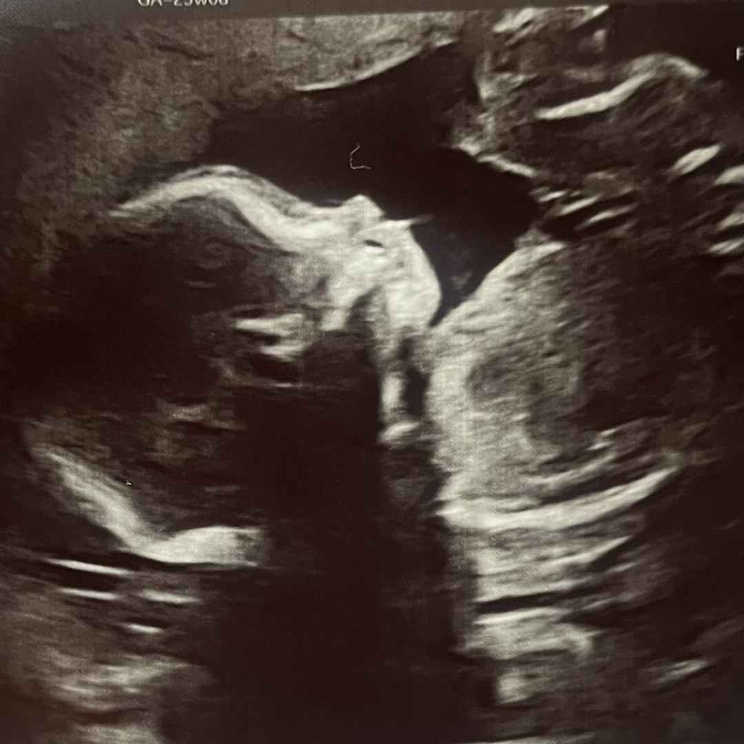 Photo shared by Natalie for their Babylist baby registry.
