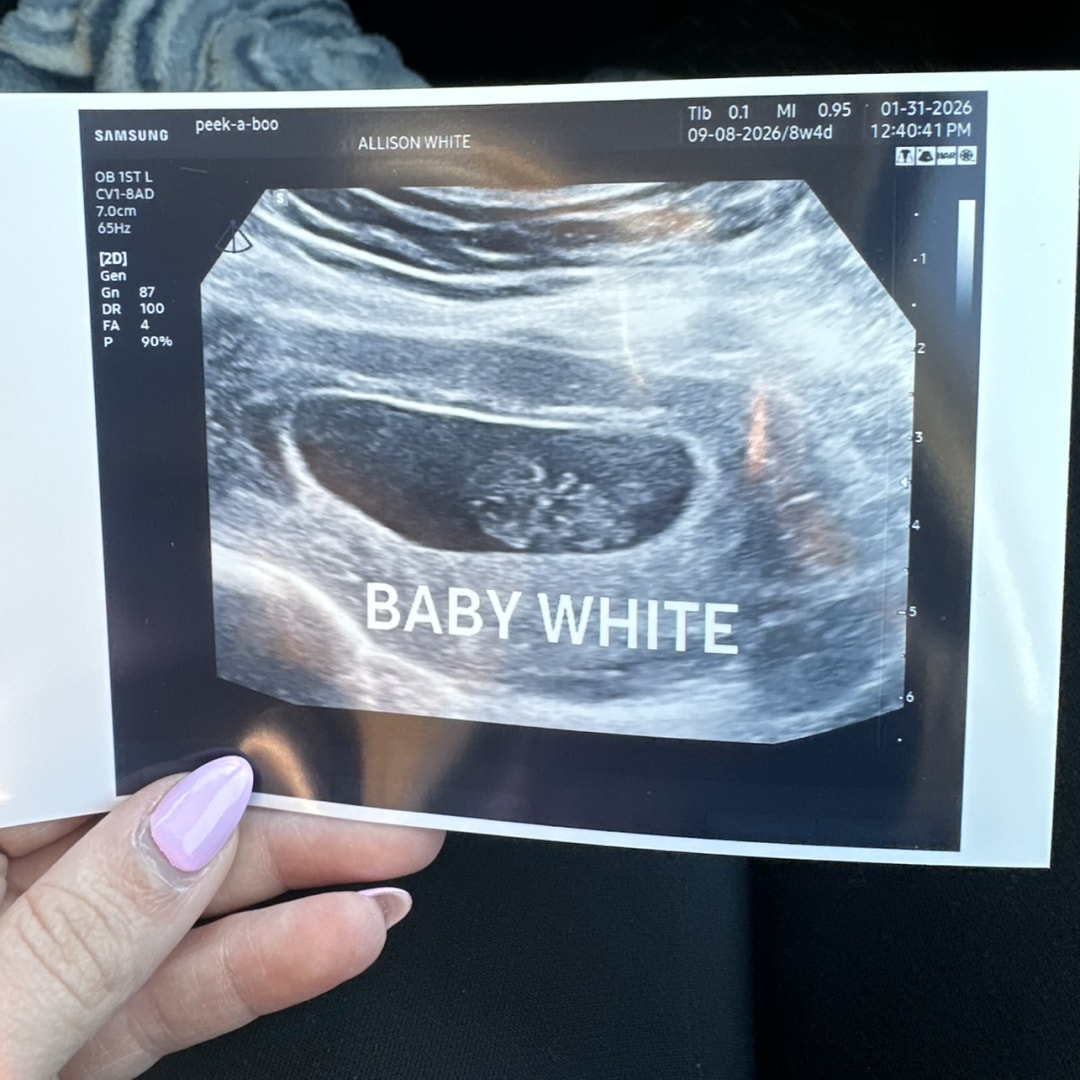 Photo shared by Allison for their Babylist baby registry.