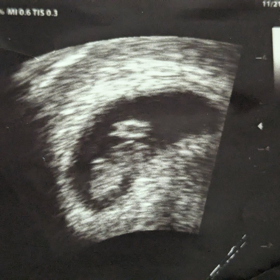 Photo shared by Christopher for their Babylist baby registry.