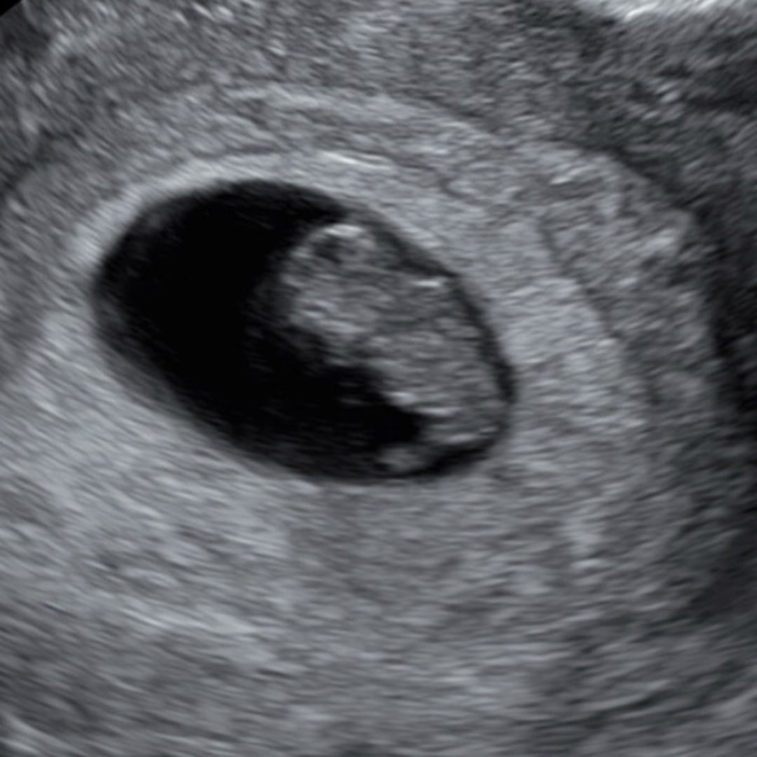 Photo shared by Veronica for their Babylist baby registry.