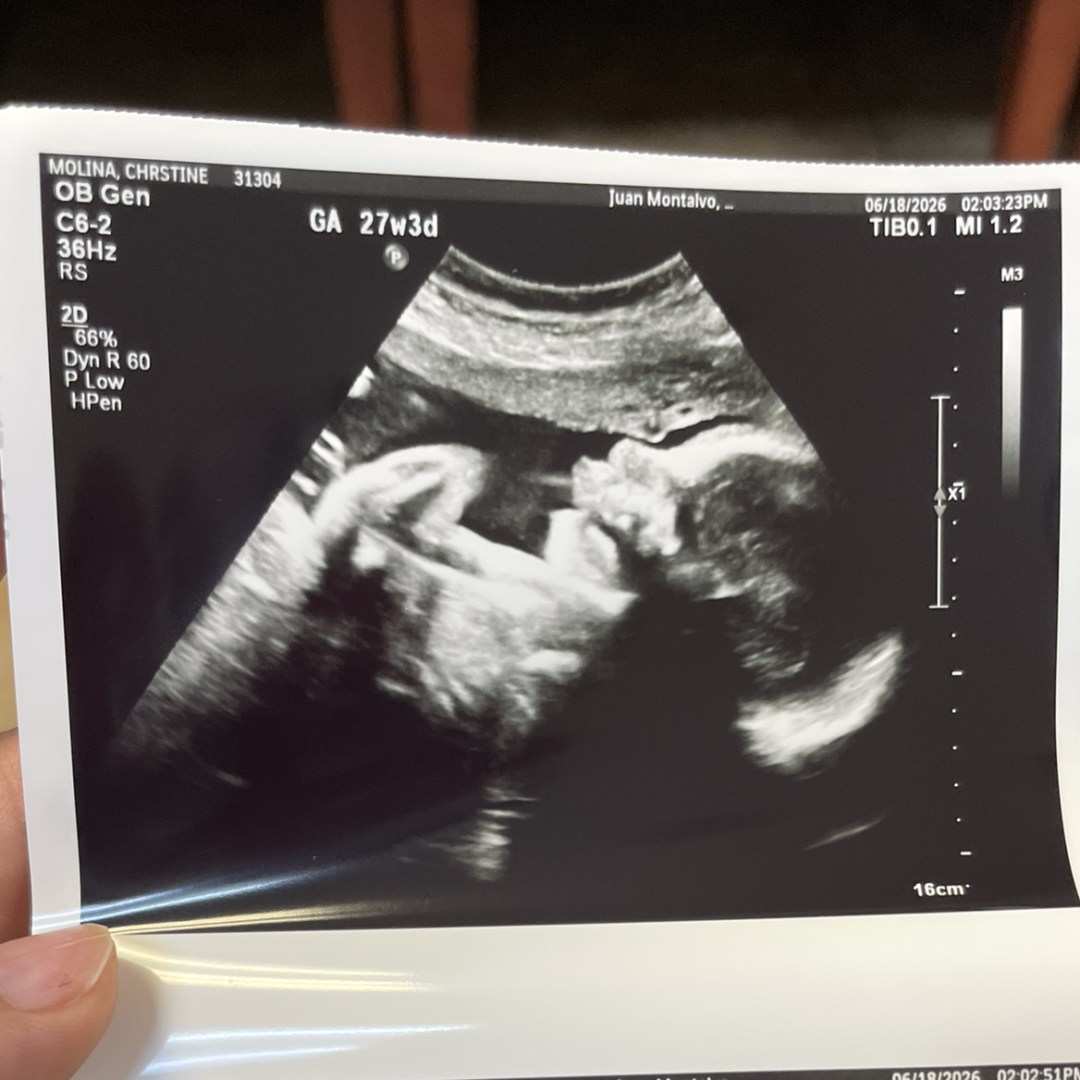 Photo shared by CHRISTINE for their Babylist baby registry.