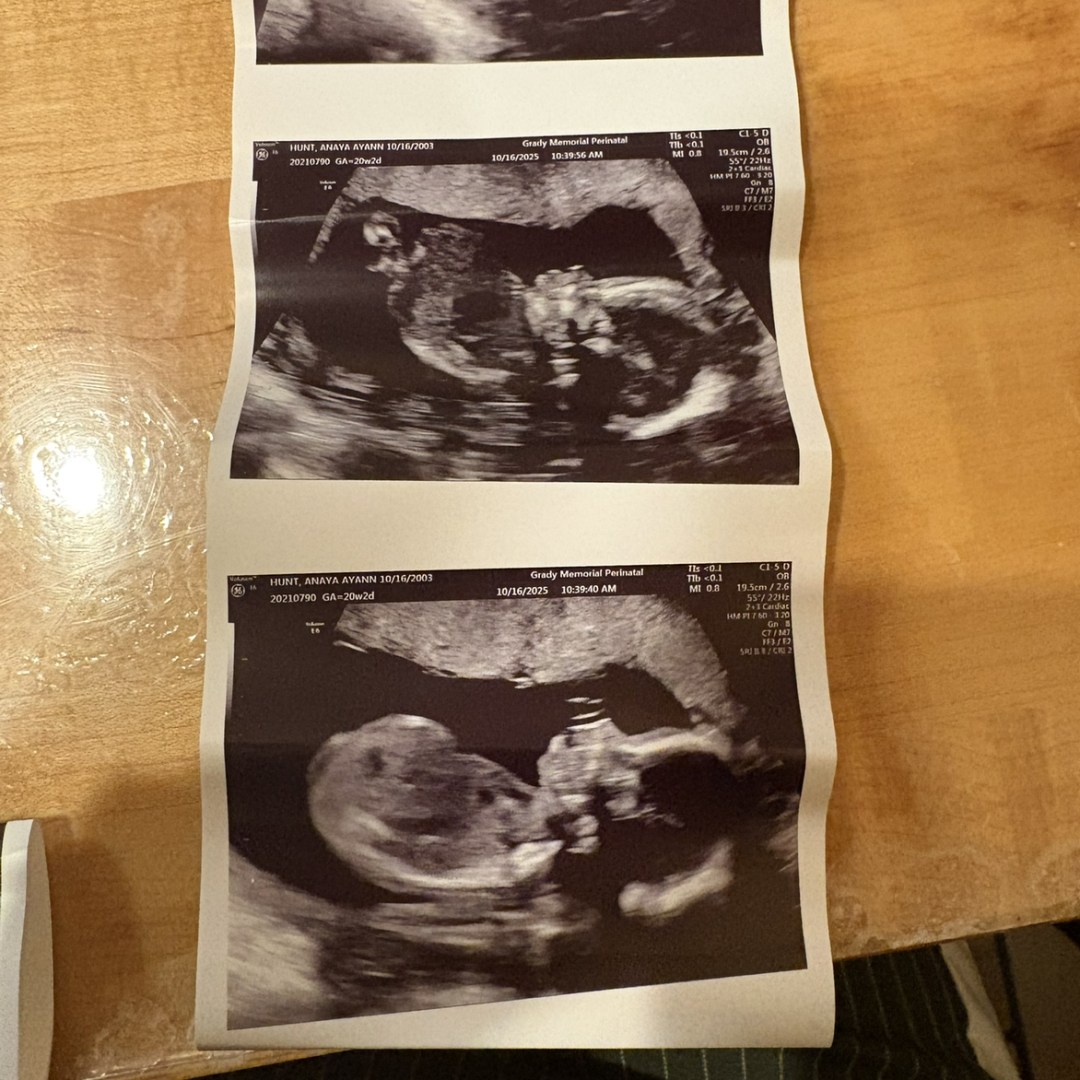 Photo shared by Anaya for their Babylist baby registry.