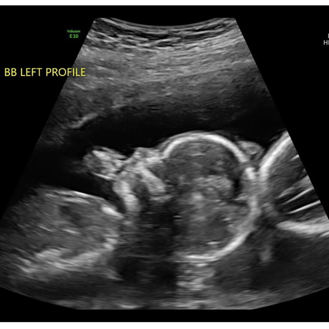 Photo shared by Reagan for their Babylist baby registry.