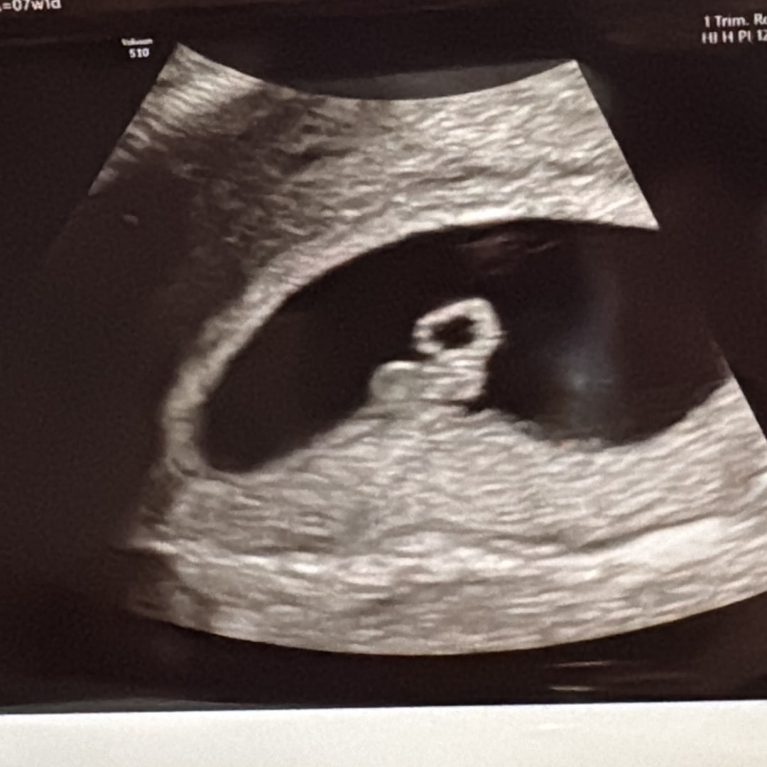 Photo shared by Gabriela for their Babylist baby registry.