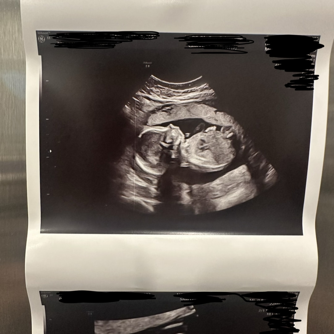 Photo shared by Ashleigh for their Babylist baby registry.