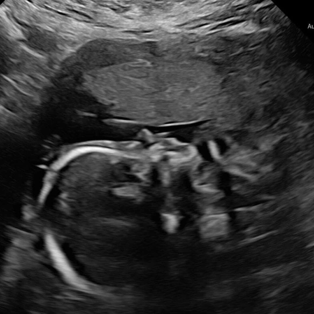 Photo shared by Jennifer for their Babylist baby registry.