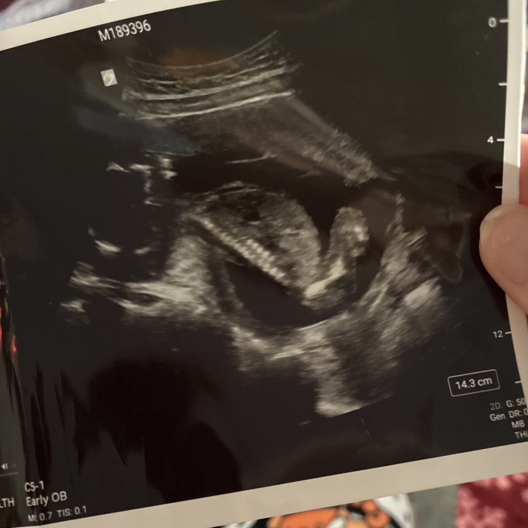 Photo shared by Alexandra for their Babylist baby registry.