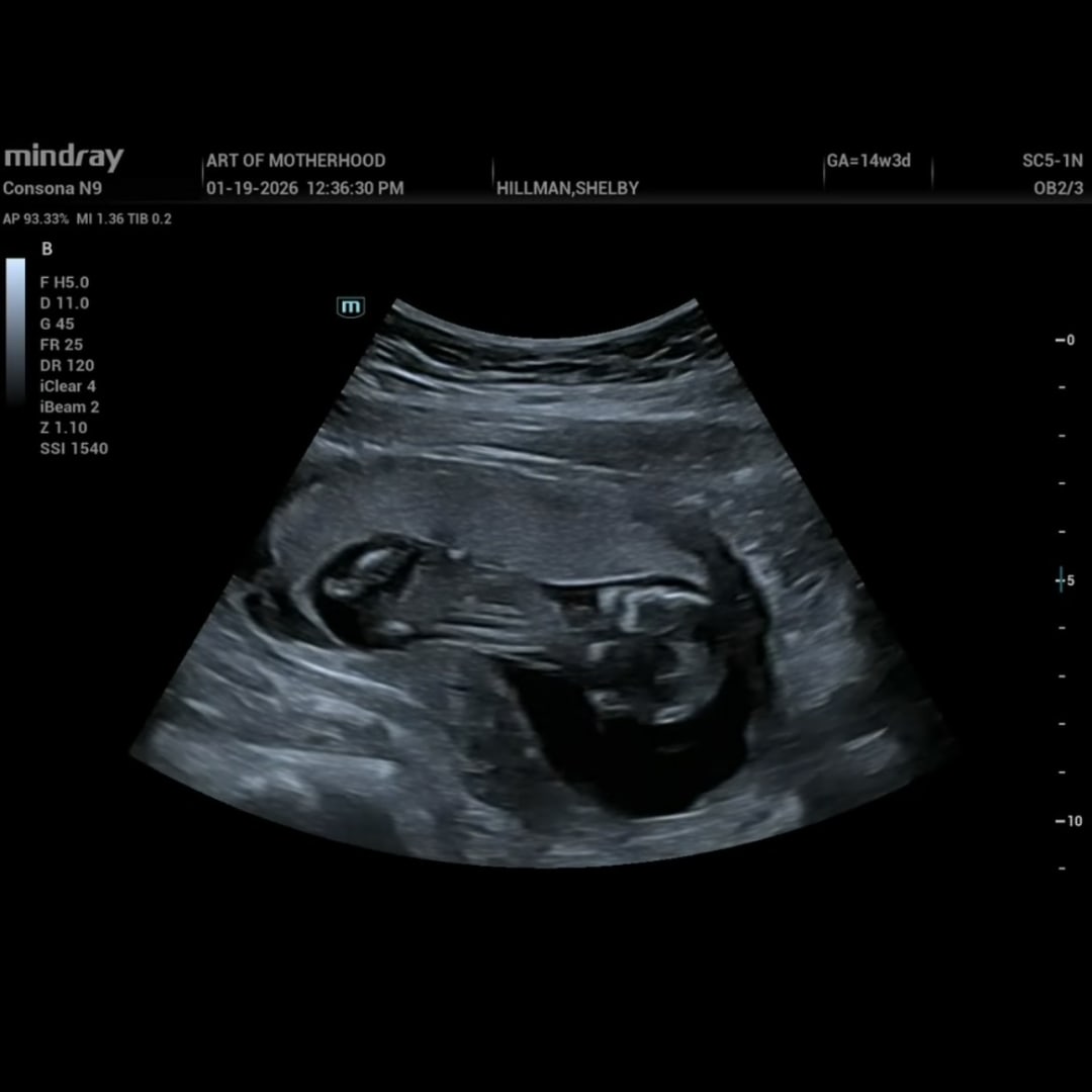 Photo shared by Seth for their Babylist baby registry.