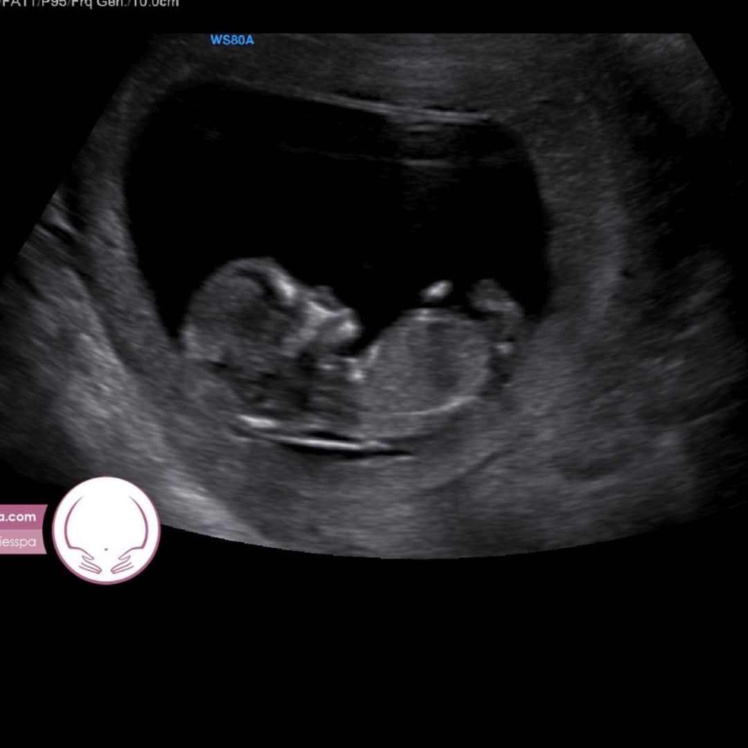 Photo shared by Michelle for their Babylist baby registry.