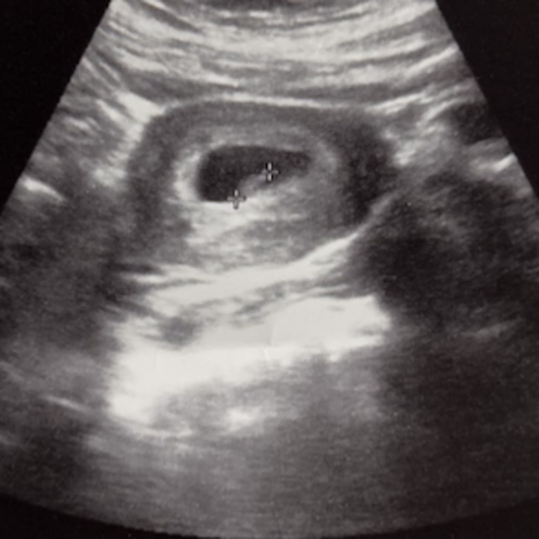 Photo shared by Amber for their Babylist baby registry.