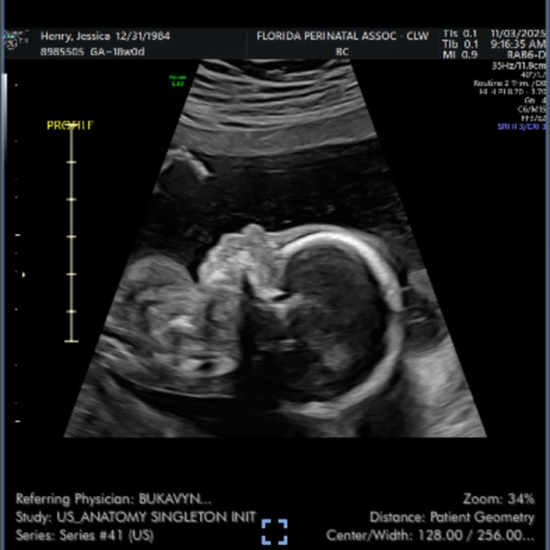 Photo shared by Jessica for their Babylist baby registry.