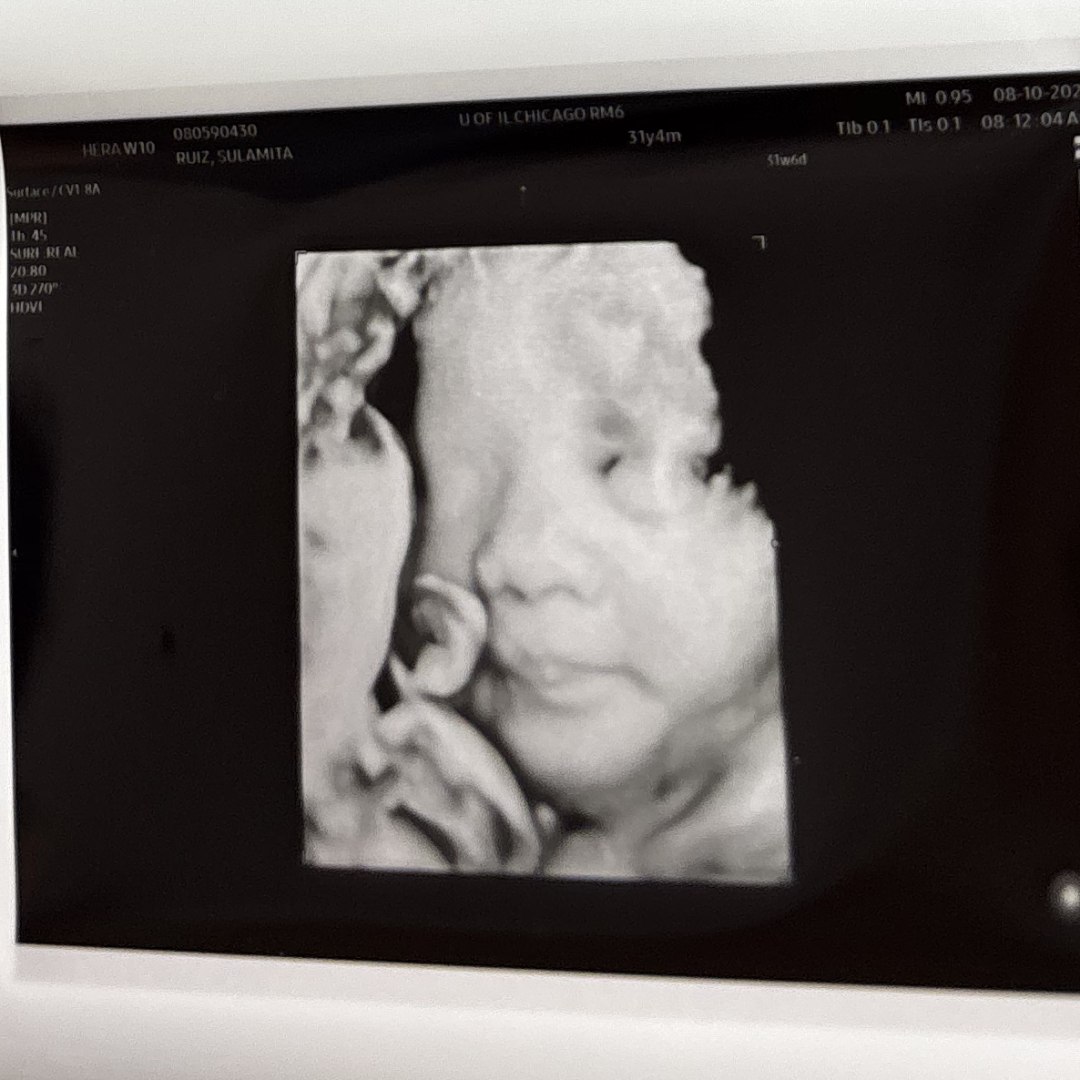 Photo shared by Sulamita for their Babylist baby registry.