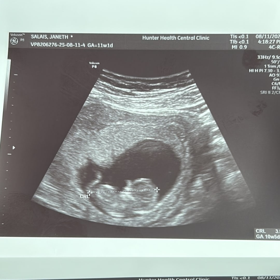 Photo shared by Janeth for their Babylist baby registry.