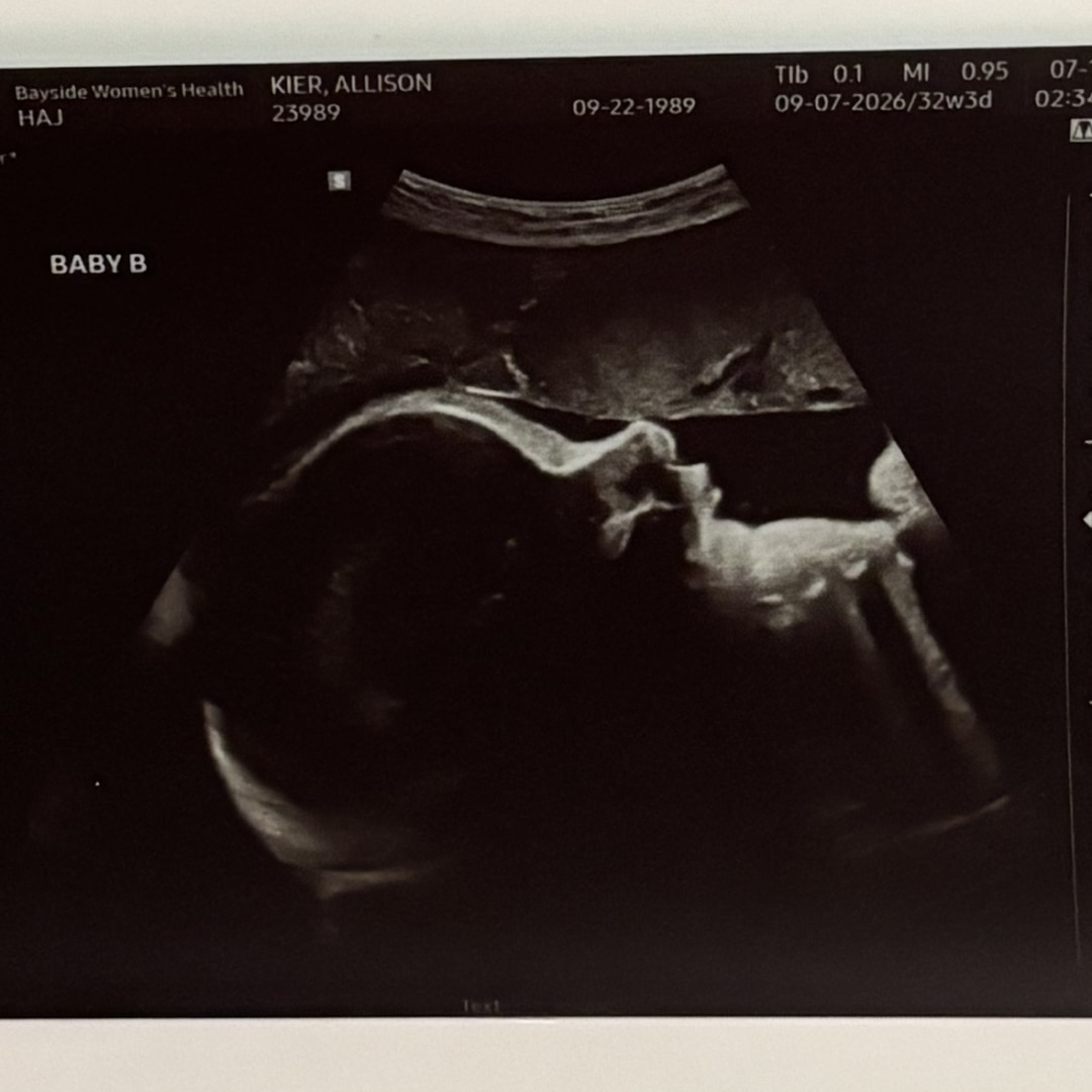 Photo shared by Allison for their Babylist baby registry.