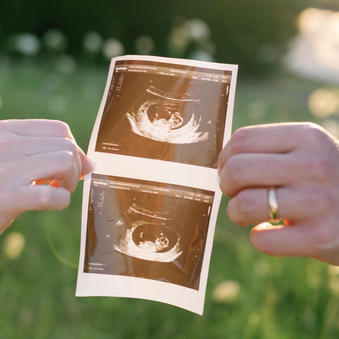 Photo shared by Caroline for their Babylist baby registry.