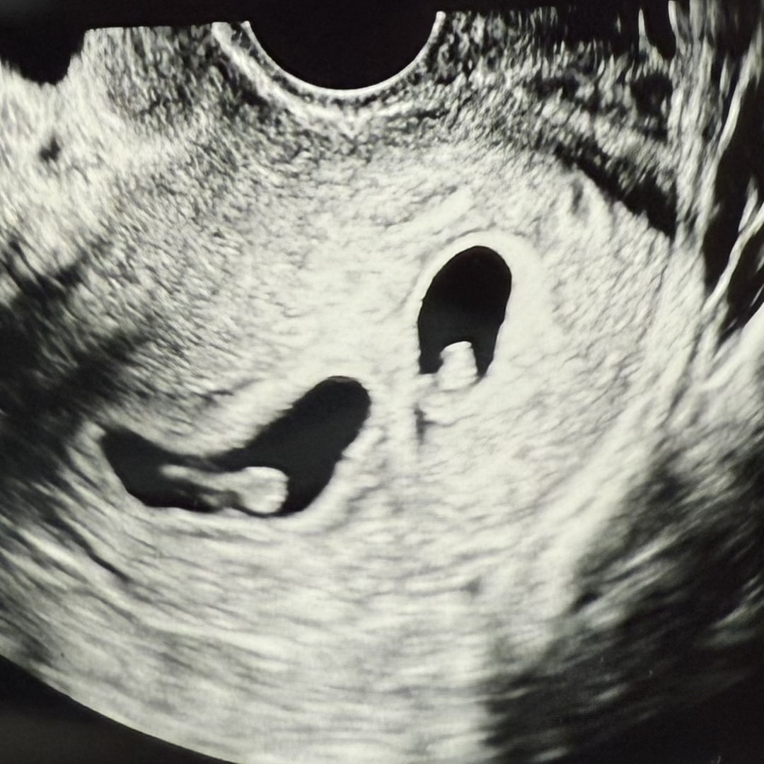 Photo shared by Amy for their Babylist baby registry.