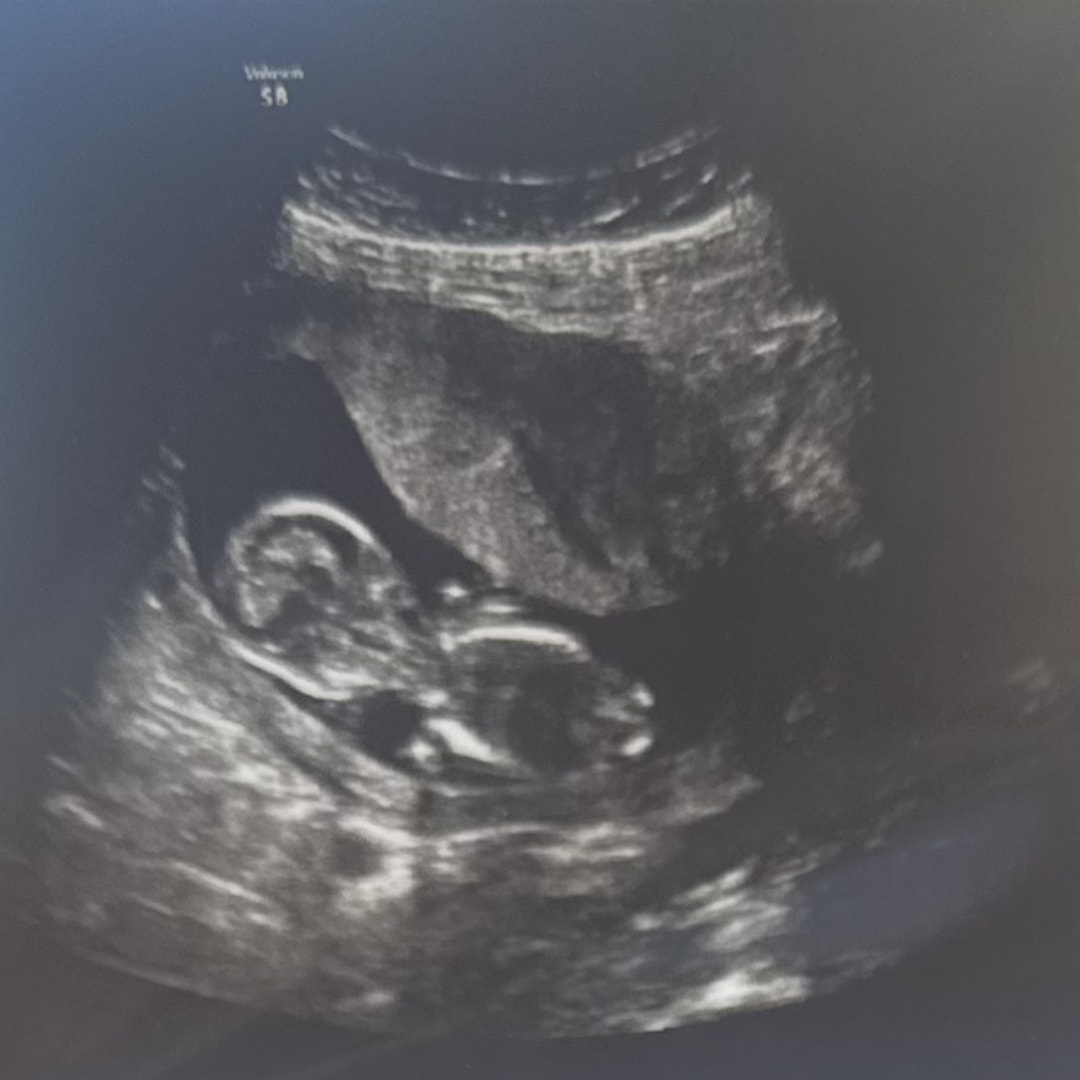 Photo shared by Gabrielle for their Babylist baby registry.