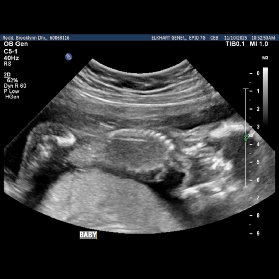 Photo shared by Brooklynn for their Babylist baby registry.