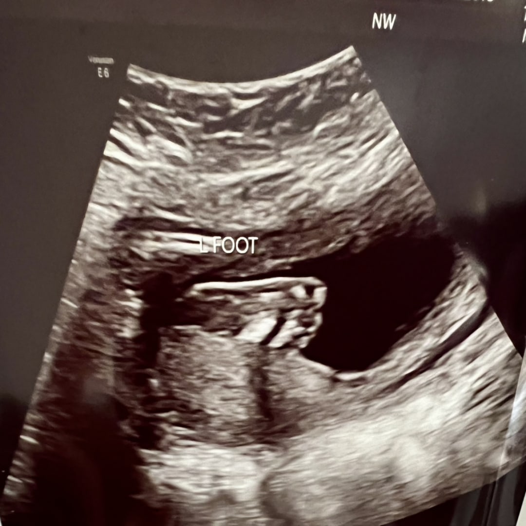 Photo shared by Jenna for their Babylist baby registry.