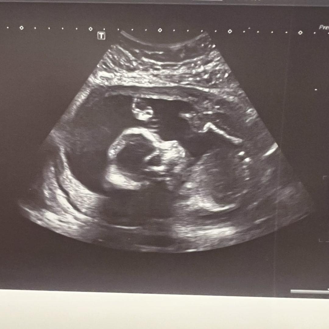 Photo shared by Alexis for their Babylist baby registry.