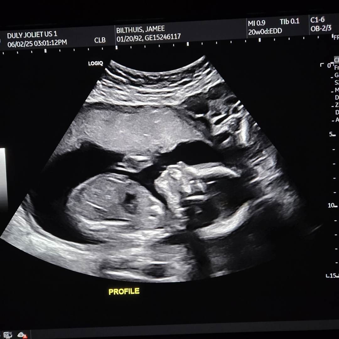 Photo shared by Jamee for their Babylist baby registry.
