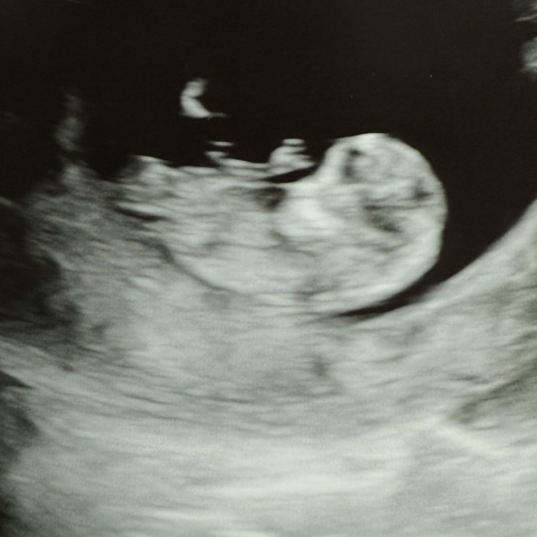 Photo shared by Adrienne for their Babylist baby registry.