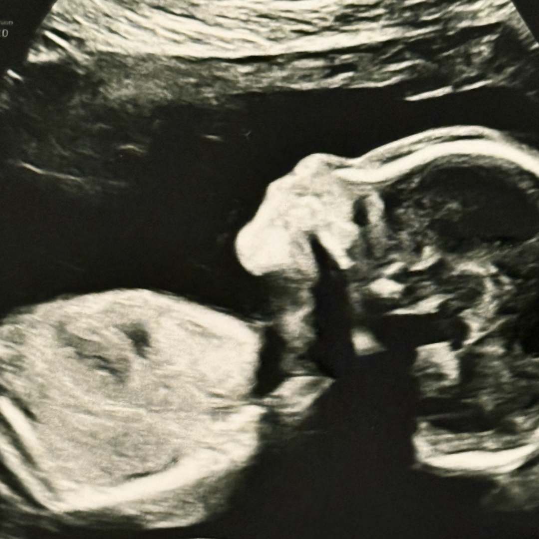 Photo shared by Irma for their Babylist baby registry.