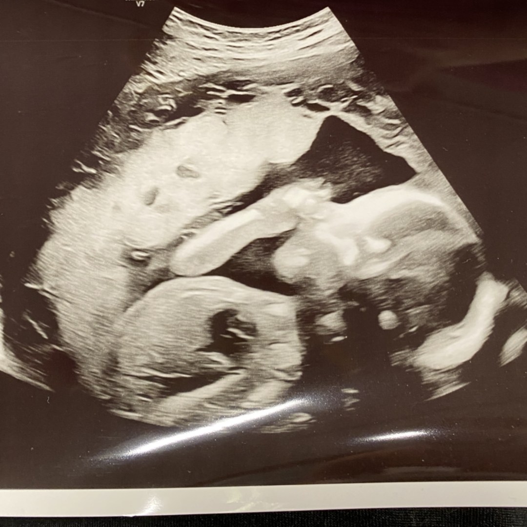 Photo shared by Jennifer for their Babylist baby registry.