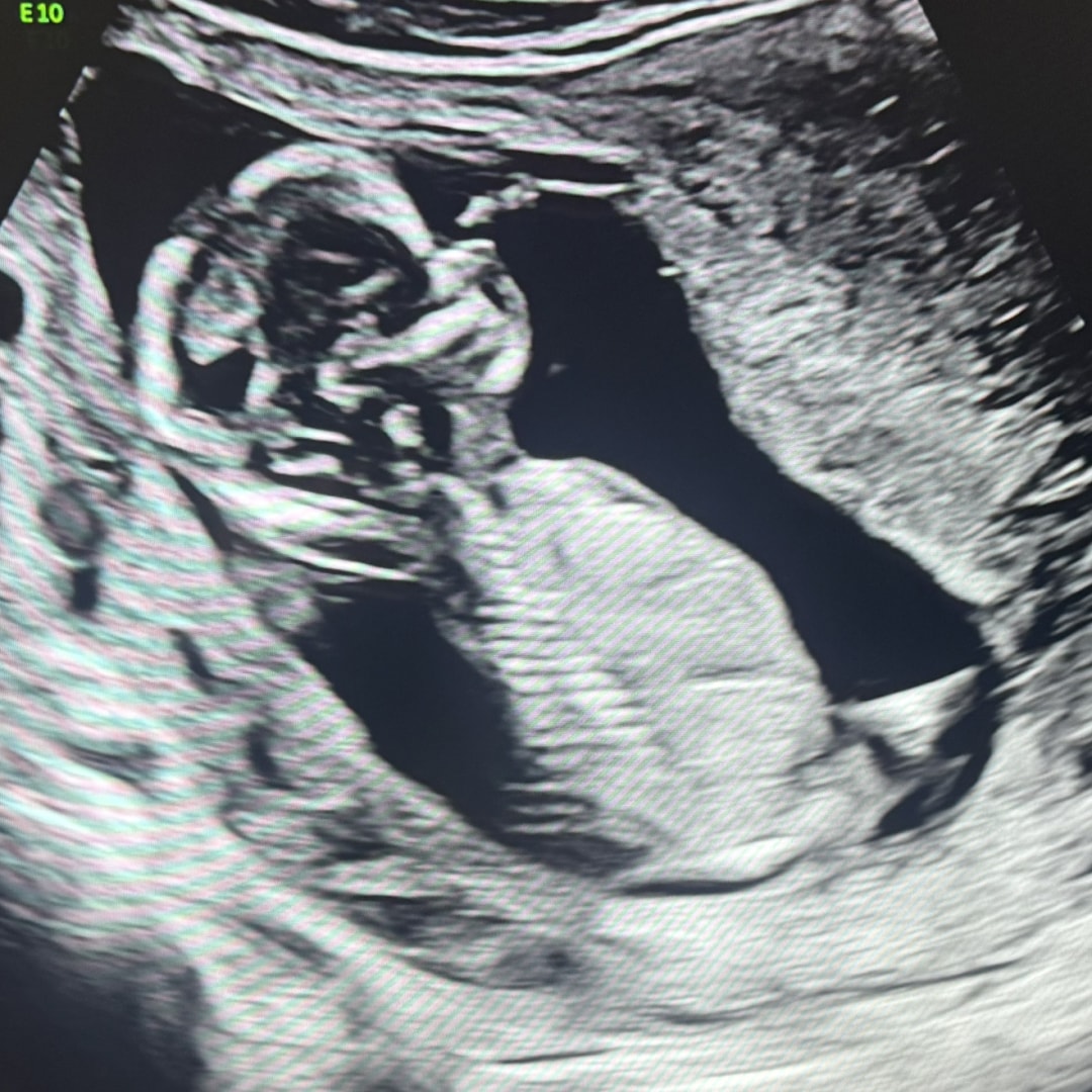 Photo shared by Innocence for their Babylist baby registry.