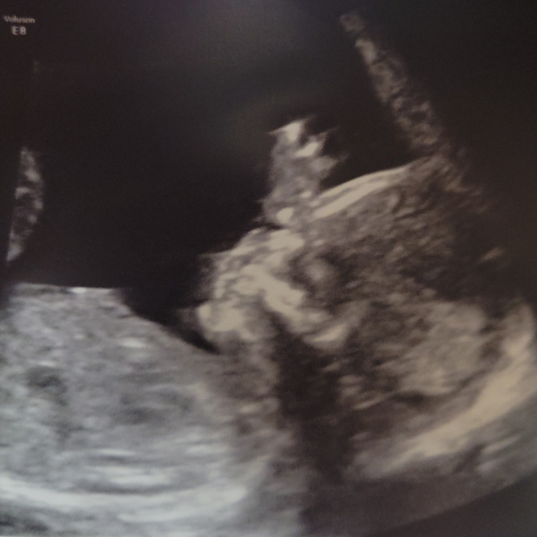 Photo shared by Christina for their Babylist baby registry.