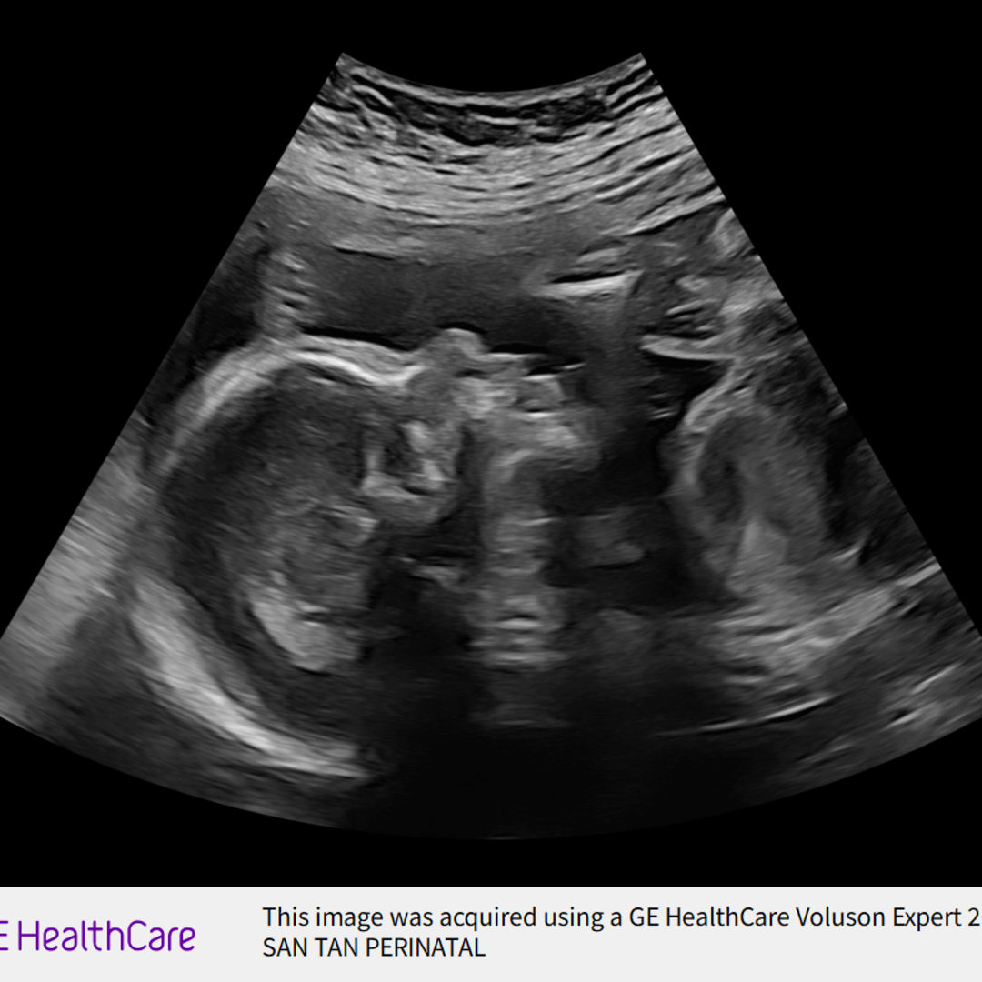 Photo shared by Leah for their Babylist baby registry.