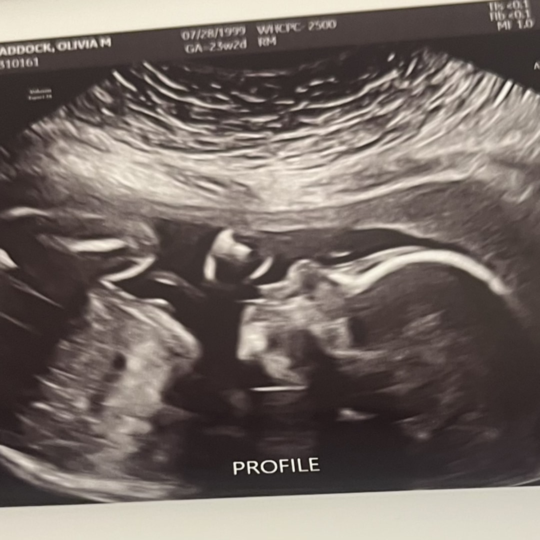 Photo shared by Olivia for their Babylist baby registry.