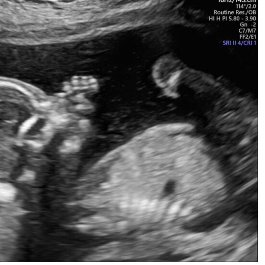 Photo shared by Sarah for their Babylist baby registry.