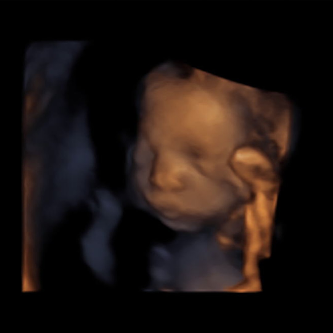 Photo shared by Arleen for their Babylist baby registry.