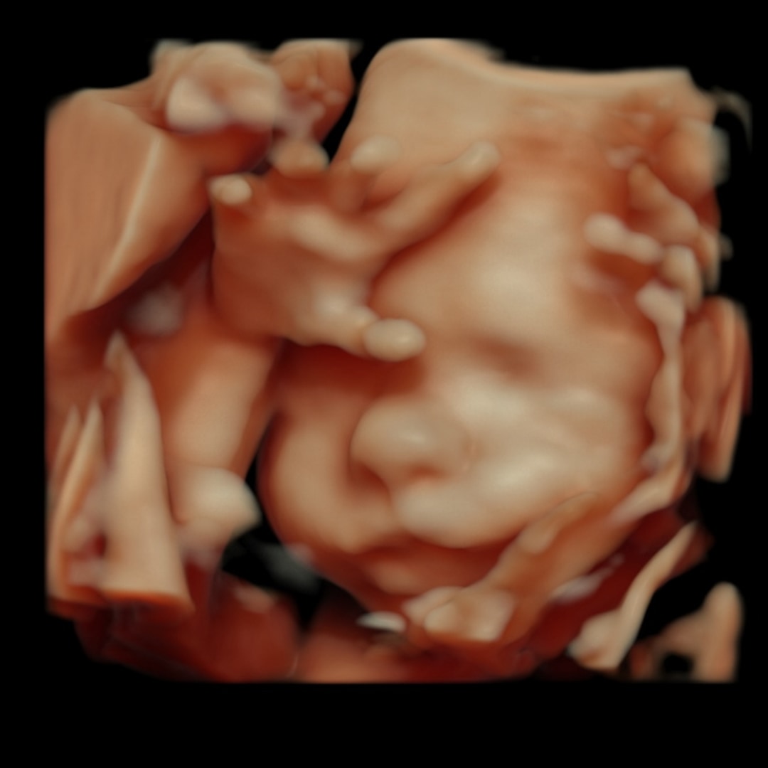 Photo shared by Baylie for their Babylist baby registry.