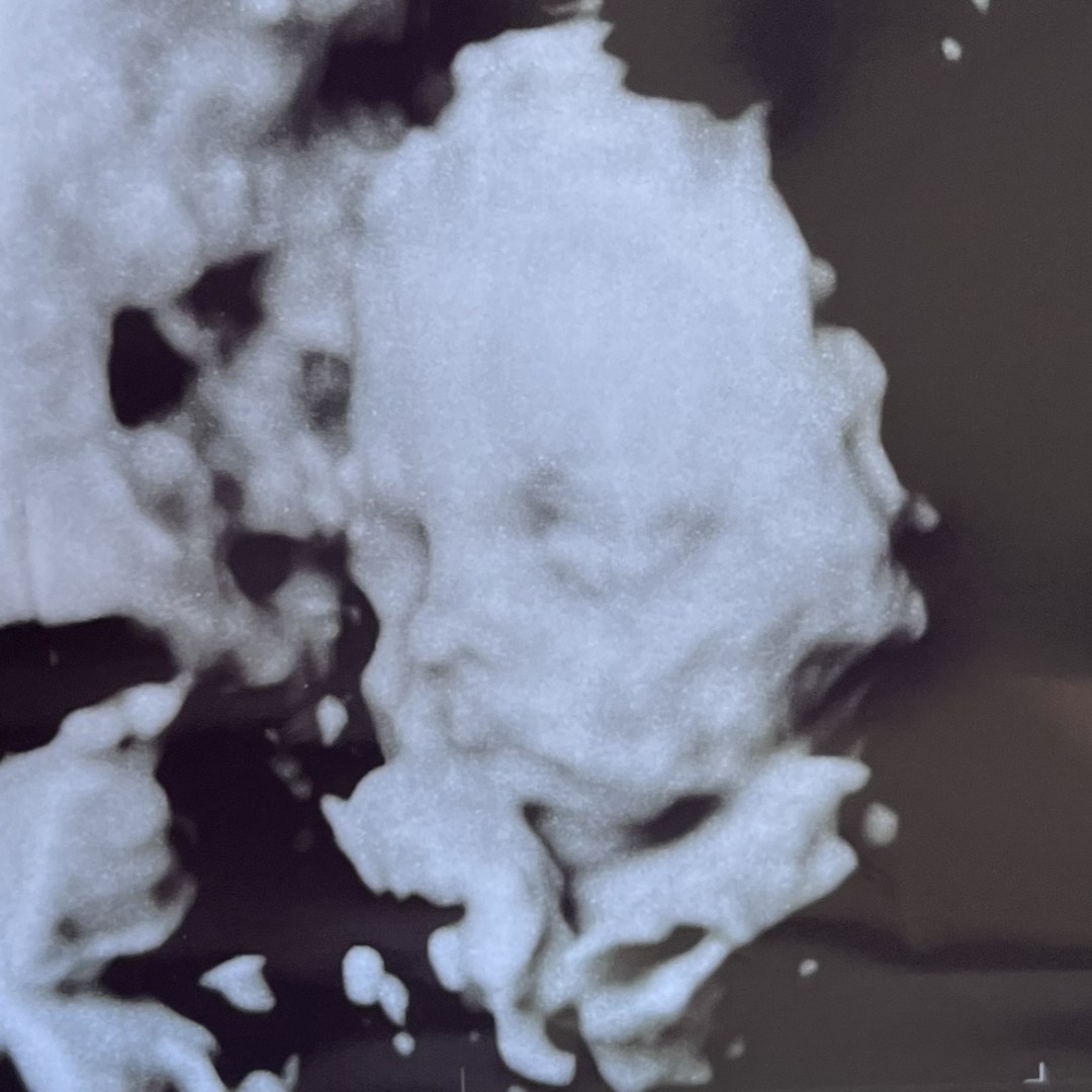 Photo shared by Adele for their Babylist baby registry.