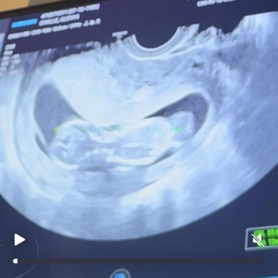 Photo shared by Glenys for their Babylist baby registry.