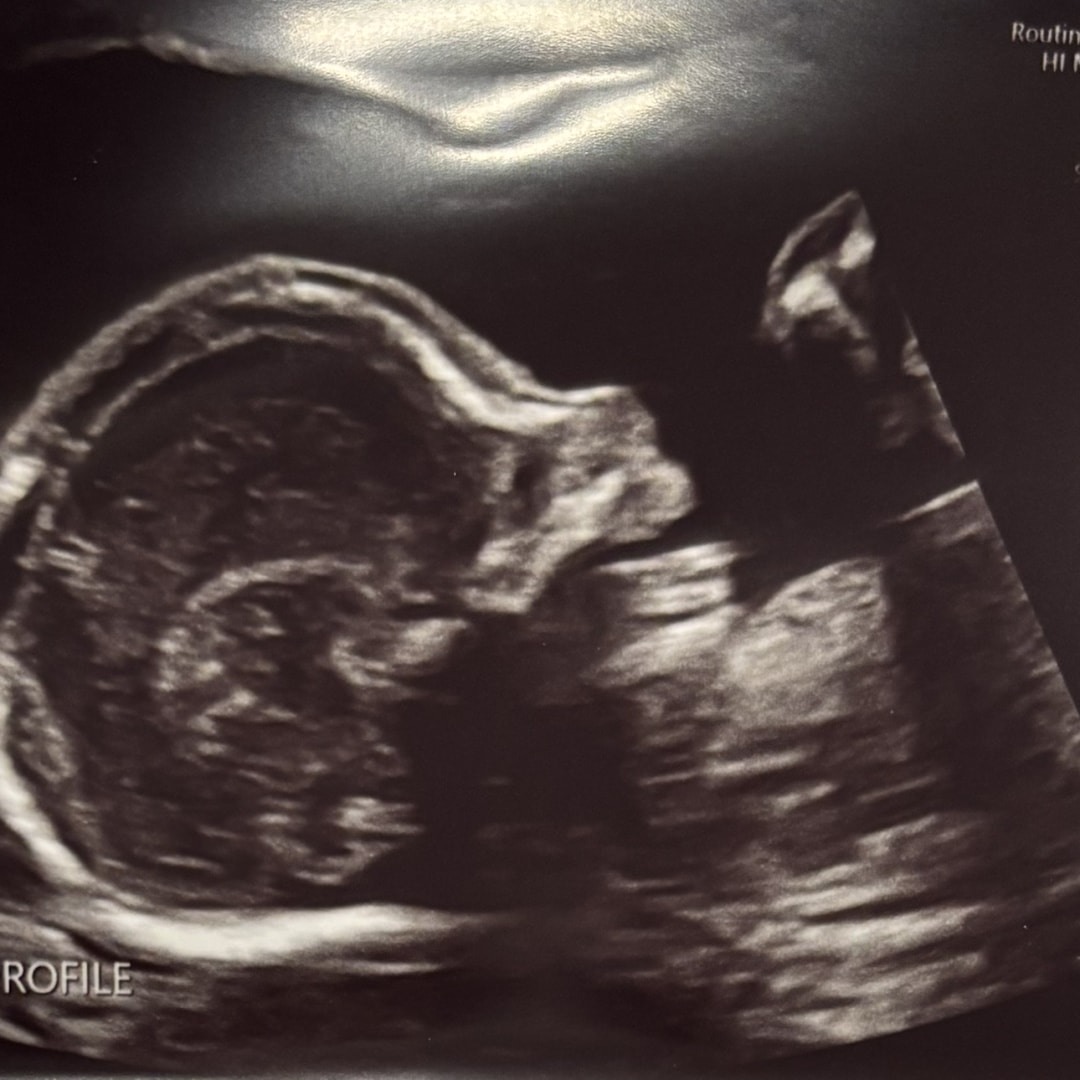 Photo shared by Aradhana for their Babylist baby registry.