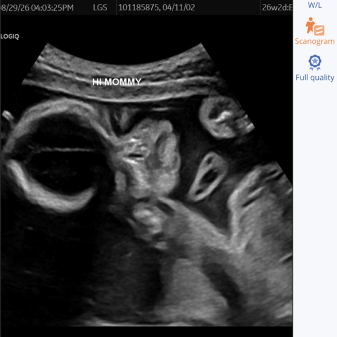 Photo shared by JaMia for their Babylist baby registry.